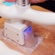 Curs Cryolipoliză