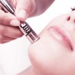 Curs Microdermabraziune