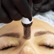 Curs Mezoterapie Microneedling