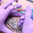 Curs Tattoo Removal