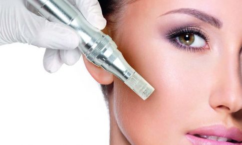 Mezoterapia cu microneedling (microace)