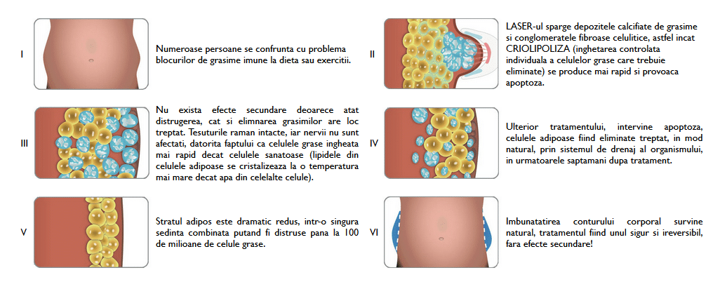 Eliminați permanent celulele de grăsime