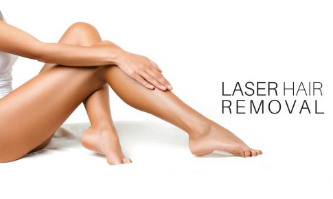 Epilarea LASER- Intrebari si Raspunsuri