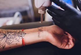 Indepartarea tatuajelor cu laser- cea mai buna si mai eficienta metoda de indepartare
