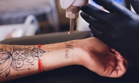 Indepartarea tatuajelor cu laser- cea mai buna si mai eficienta metoda de indepartare
