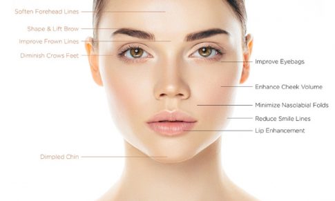 Botox sau acidul hialuronic? Care este cea mai buna optiune?