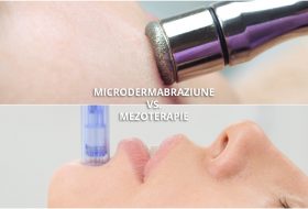 Microneedling sau Microdermabraziune? Care este cea mai buna optiune?