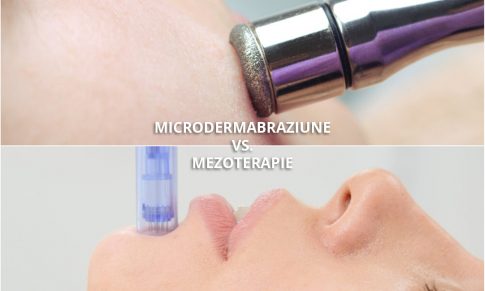 Microneedling sau Microdermabraziune? Care este cea mai buna optiune?